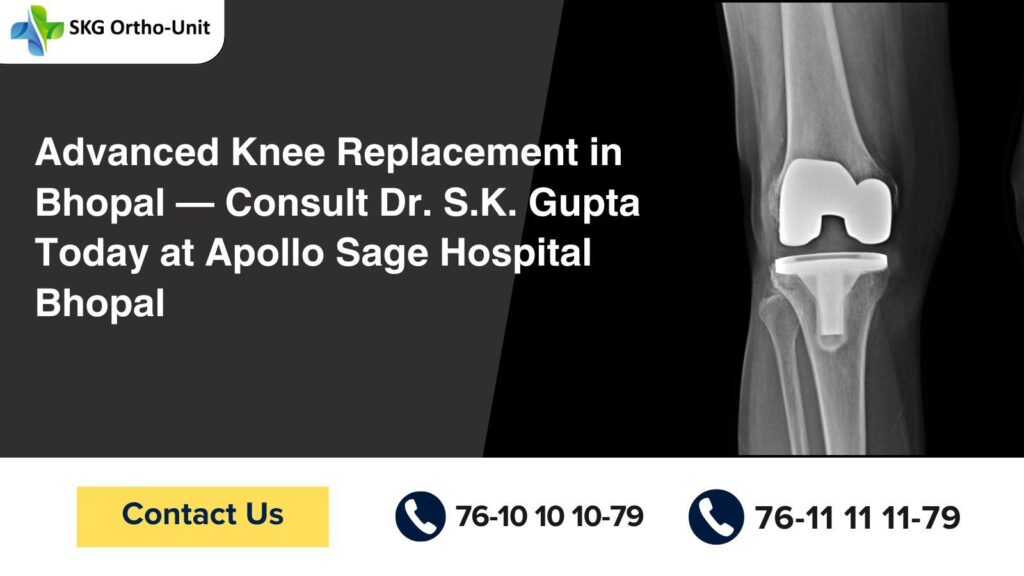 Best Knee Replacement Surgery in Bhopal: Reclaim Your Mobility with Dr. S.K. Gupta at Apollo Sage Hospital