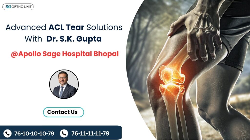 Best ACL Surgery for Khandwa | +91 76 101010 79